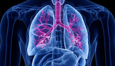 什么是慢性阻塞性肺病 (Chronic Obstructive Pulmonary Disease)，為何與新冠疫情有關？